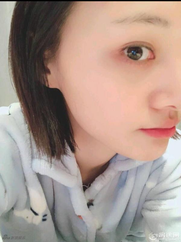 郑爽晒素颜照皮肤白皙大眼水灵