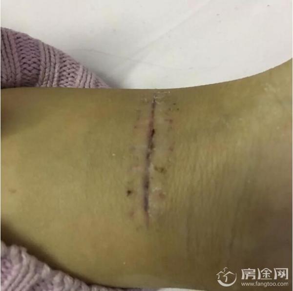 女生自述被老师性侵后割腕