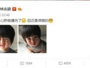 林志颖晒小儿子受伤照 林志颖小儿子为什么受伤 严重吗