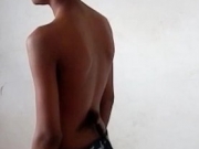 13岁印度男孩生来背部长了条“尾巴” 被当地人认为是猴神化身而受崇拜